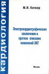 Электрокардиографические заключения и краткое описание изменений ЭКГ