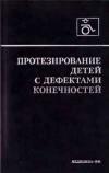 Протезирование детей с дефектами конечностей