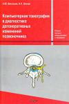 Компьютерная томография в диагностике дегенеративных изменений позвоночника