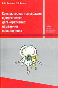 Компьютерная томография в диагностике дегенеративных изменений позвоночника