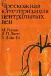 Чрескожная катетеризация центральных вен