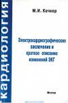 Электрокардиологическое заключение и краткое описание изменений ЭКГ